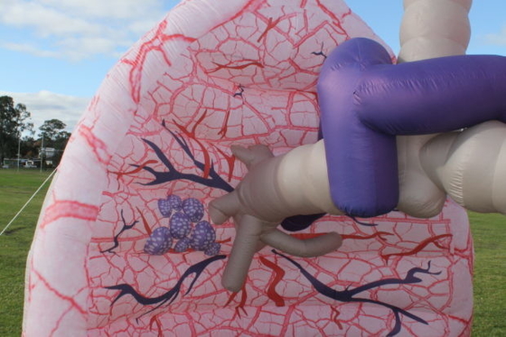 Giant Inflatable Lung Model Advertising For Medical Exhibition Events